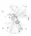 Fig. 13 - Laser scanning apparatus and method of use