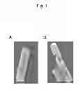 Fig. 02 - Lactic acid bacterium agent for improving lipid metabolism