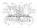 Fig. 01 - Electricity accumulation device