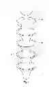 Fig. 02 - Dental implant utilizing a polymeric post