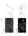 Fig. 09 - Methods For and Uses of Mechanical Stiffness Profiling of Cancer Cells