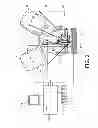 Fig. 03 - Lesion imaging optimization using a tomosynthesis/biopsy system