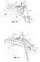 Fig. 09 - Methods and instruments for subchondral treatment of osteoarthritis in a small joint