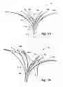 Fig. 09 - Devices, systems and methods for enclosing an anatomical opening