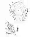 Fig. 02 - Trans-catheter ventricular reconstruction structures, methods, and systems for treatment of congestive heart failure and other conditions