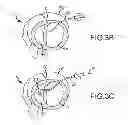 Fig. 07 - Trans-catheter ventricular reconstruction structures, methods, and systems for treatment of congestive heart failure and other conditions