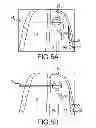 Fig. 09 - Trans-catheter ventricular reconstruction structures, methods, and systems for treatment of congestive heart failure and other conditions