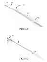 Fig. 28 - Trans-catheter ventricular reconstruction structures, methods, and systems for treatment of congestive heart failure and other conditions