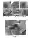 Fig. 48 - Trans-catheter ventricular reconstruction structures, methods, and systems for treatment of congestive heart failure and other conditions