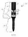 Fig. 43 - Pedicle screw having a removable rod coupling