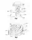 Fig. 02 - Implant with compliant layer