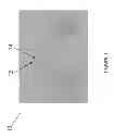 Fig. 02 - Magnesium Alloys for Bioabsorbable Stent