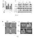 Fig. 06 - Methods and compositions for enhanced Agrobacterium-mediated transformation Efficiency