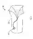 Fig. 03 - WRIST AND FOREARM PROTECTOR AND METHOD FOR ITS USE