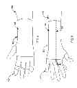 Fig. 04 - WRIST AND FOREARM PROTECTOR AND METHOD FOR ITS USE