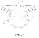 Fig. 13 - Disposable medical gown