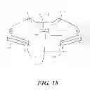 Fig. 14 - Disposable medical gown