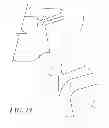 Fig. 15 - Disposable medical gown