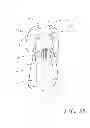 Fig. 19 - Disposable medical gown