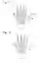 Fig. 07 - GLOVE