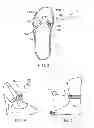 Fig. 04 - Selective ornamentation system