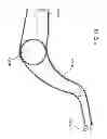 Fig. 18 - Protective apparel and support apparatus and method of use