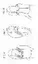 Fig. 30 - Protective apparel and support apparatus and method of use