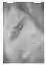 Fig. 08 - Therapeutic pillow with hand rest