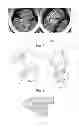 Fig. 03 - Method for driving clothes to roll in upright barrel by using impellers and application thereof