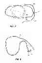 Fig. 05 - Clamp for adjustably joining the ends of a strap