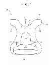 Fig. 06 - Side Release Buckle