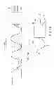 Fig. 02 - Adjustable support for tubular medical device processing