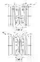Fig. 03 - Mounting system for sporting equipment
