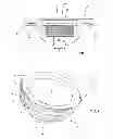 Fig. 03 - Method for producing a ceramic acetabulum