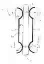 Fig. 01 - EXPANDABLE MEDICAL IMPLANT