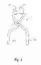 Fig. 04 - EXPANDABLE MEDICAL IMPLANT