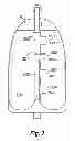 Fig. 04 - Manual emergency resuscitator with pre-defined volume control