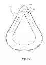 Fig. 41 - Cushion for patient interface