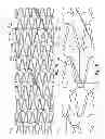 Fig. 02 - REMOVAL OF AN ISLAND FROM A LASER CUT ARTICLE