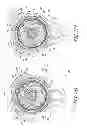 Fig. 09 - Reel-based lacing system
