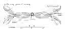 Fig. 01 - METHODS AND COMPOSITIONS FOR DIAGNOSIS OF IGA-AND IGM-MEDIATED KIDNEY DISEASES