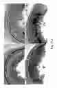Fig. 25 - METHOD OF TREATING OR PREVENTING HEARING LOSS