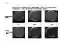 Fig. 04 - THERAPEUTIC AGENT FOR ISCHEMIC DISEASES