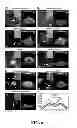Fig. 07 - Methods of regulating uptake and transcellular transport of leukocytes and therapeutics
