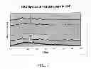 Fig. 08 - SOL-GEL DERIVED BIOACTIVE GLASS POLYMER COMPOSITE