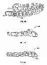Fig. 06 - Systems and methods for fabricating a dental template