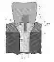 Fig. 01 - Dental implant system