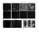 Fig. 02 - DROSOPHILA TUMOR STEM CELL MODEL AND USES THEREOF
