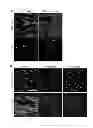 Fig. 04 - DROSOPHILA TUMOR STEM CELL MODEL AND USES THEREOF