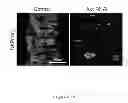 Fig. 09 - DROSOPHILA TUMOR STEM CELL MODEL AND USES THEREOF